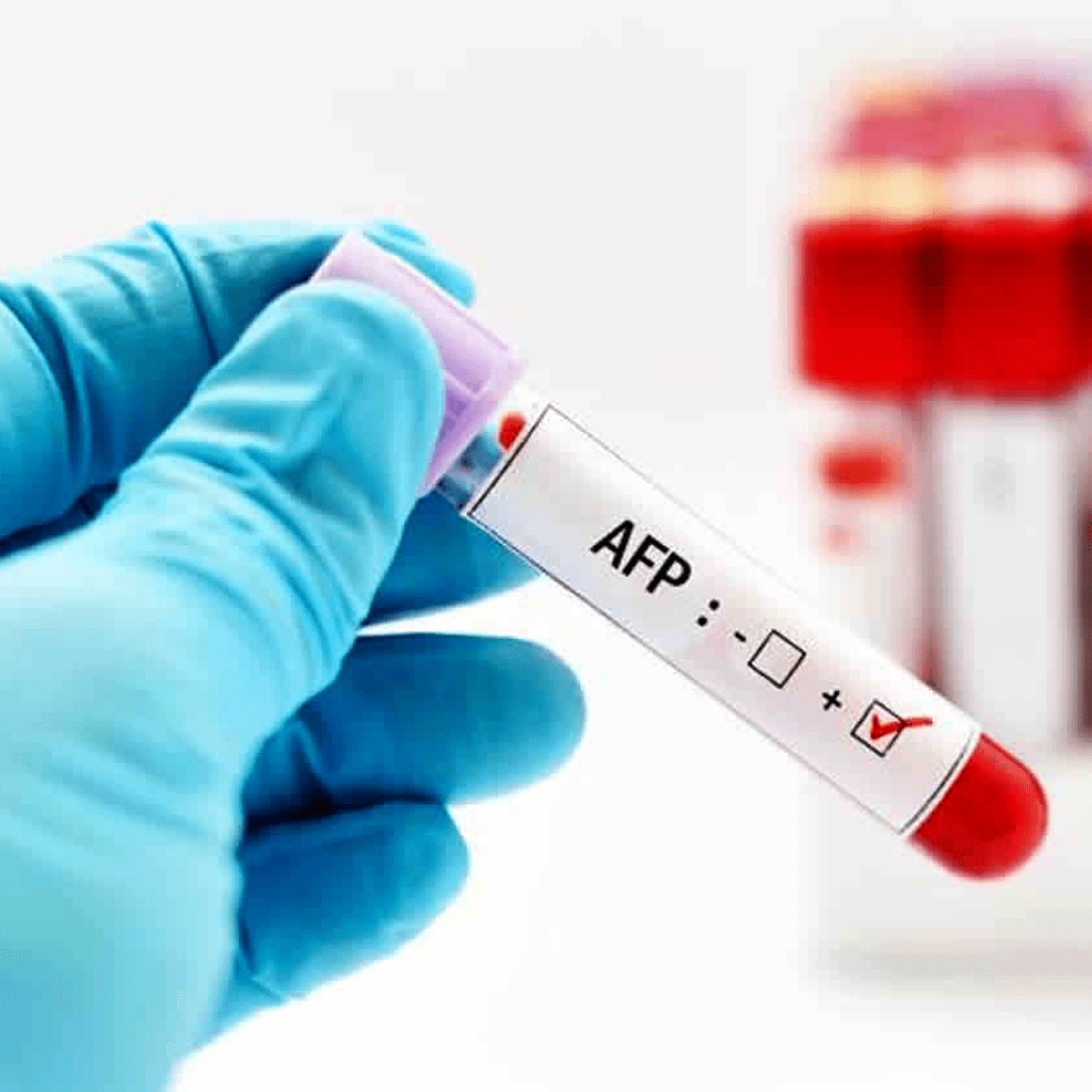 AFP_test.png