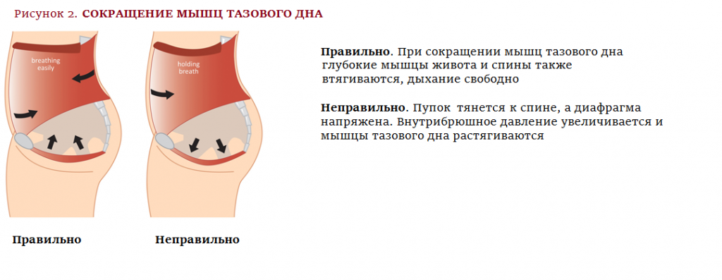 Рисунок 2 Дисфункция тазового дна.png
