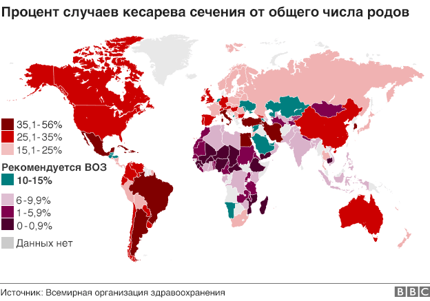статистика кесарева сечения